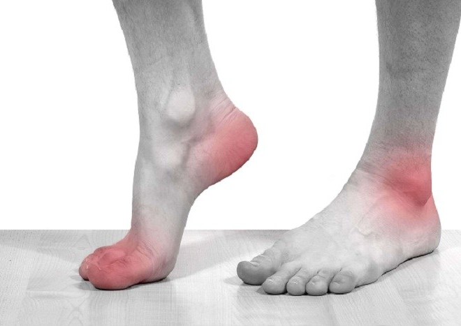 Bệnh gút có nguy hiểm đến tính mạng không? Bệnh gút có chết không?